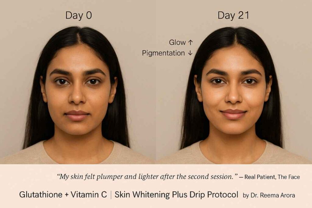 Before and after IV therapy results at The Face Clinic, India showing improved hydration, glowing skin, and wellness transformation.