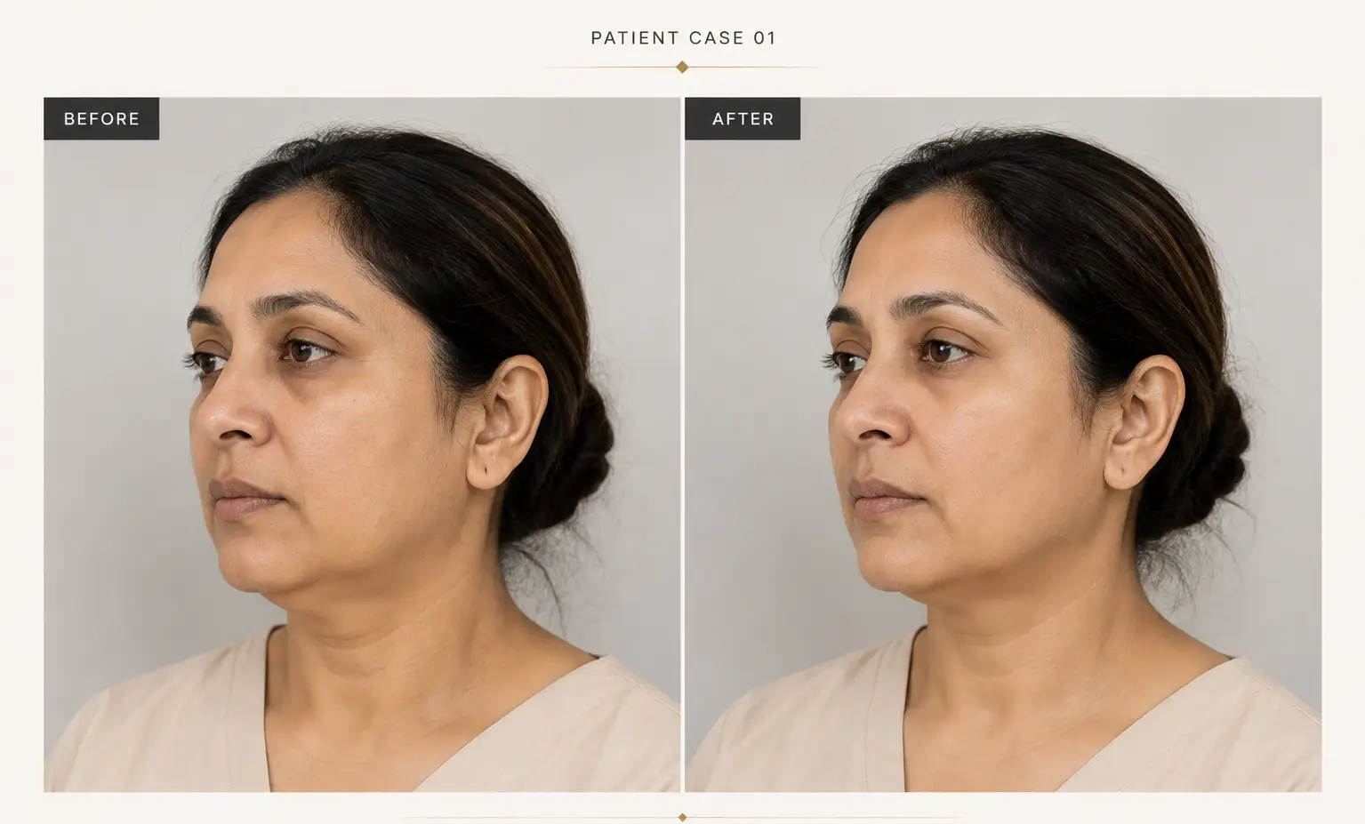 Patient case 1 before treatment