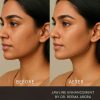 Before and after jawline fillers for a sharper, sculpted jawline